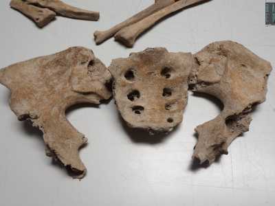 ...le scapole, le braccia e la base del bacino